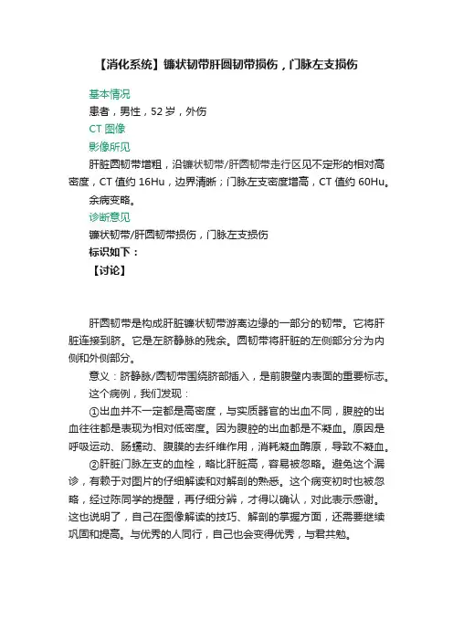 【消化系统】镰状韧带肝圆韧带损伤，门脉左支损伤