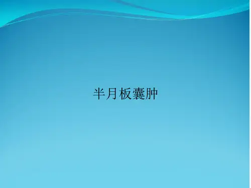 半月板囊肿