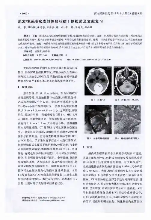 原发性后颅窝成熟性畸胎瘤1例报道及文献复习
