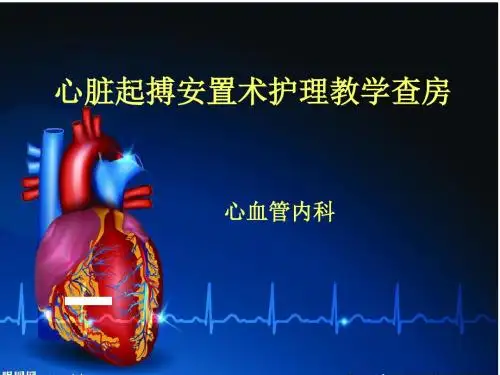 起搏器教学查房