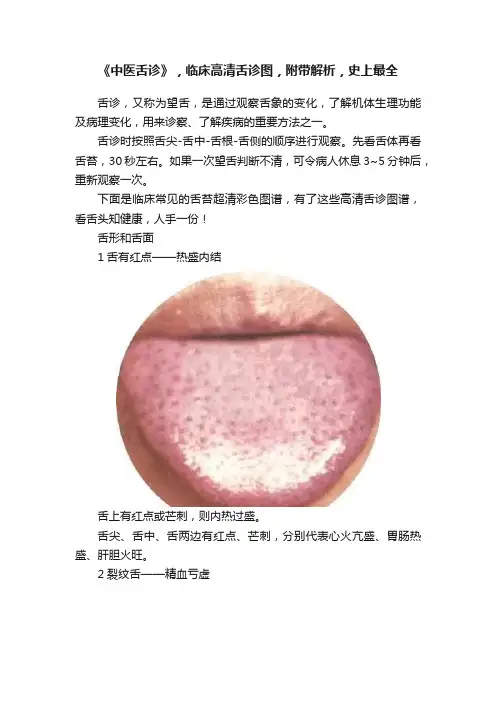 《中医舌诊》，临床高清舌诊图，附带解析，史上最全