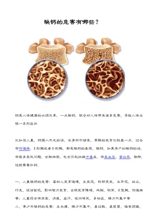 缺钙的危甑有哪些