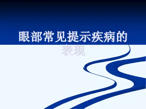 眼部常见提示疾病的表现[可修改版ppt]