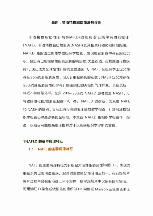 最新：非酒精性脂肪性肝病诊断
