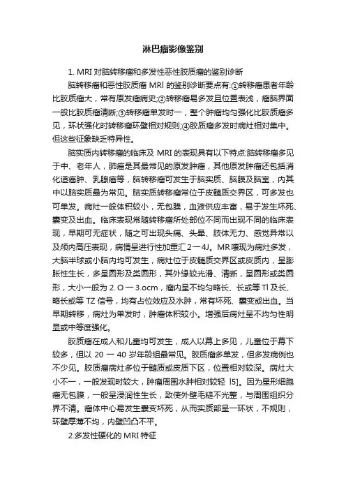 淋巴瘤影像鉴别