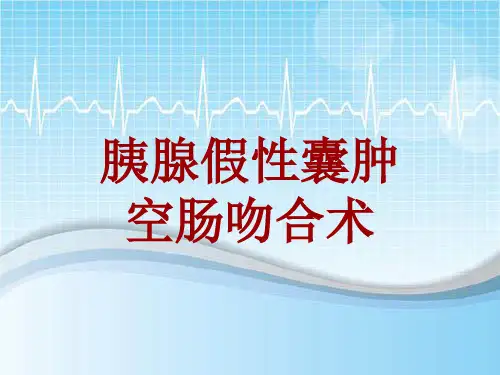 手术讲解模板：胰腺假性囊肿空肠吻合术