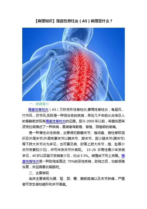 【病理知识】强直性脊柱炎（AS）病理是什么？