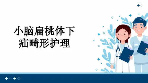 小脑扁桃体下疝畸形护理