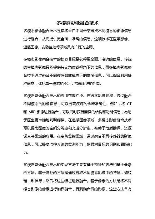 多模态影像融合技术