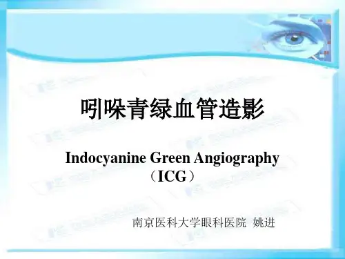 ICG检查