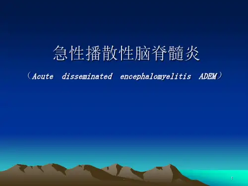 急性播散性脑脊髓炎课件PPT课件