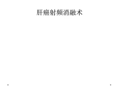 肝癌射频消融术