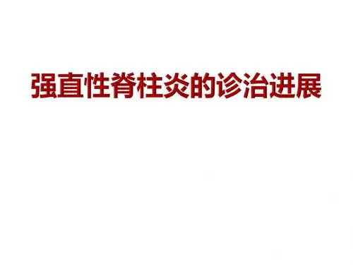 强直性脊柱炎的诊治进展