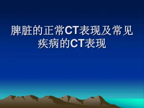 脾脏的正常CT表现ppt医学课件