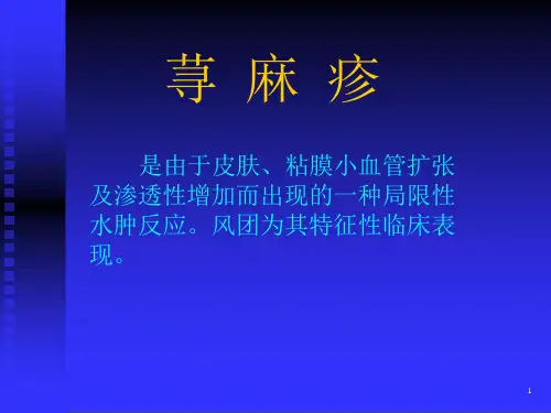 荨麻疹介绍ppt课件