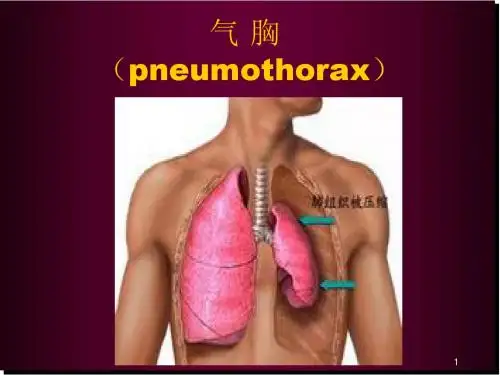 气胸PPT医学PPT课件