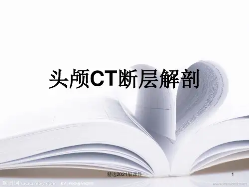 头颅CT断层解剖72385
