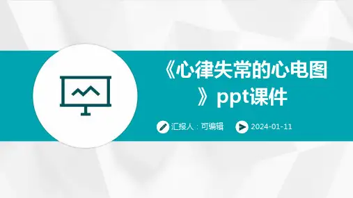 《心律失常的心电图》PPT课件