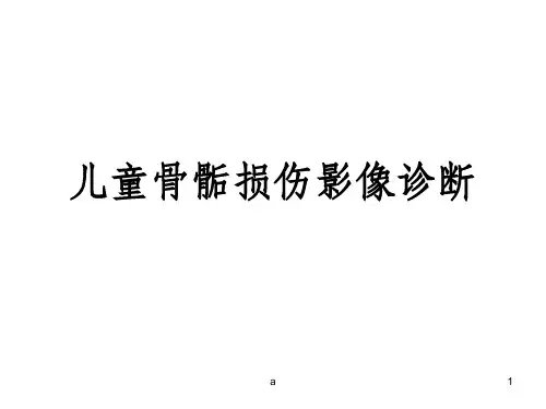 儿童骨骺损伤影像诊断
