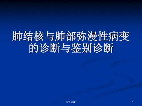 肺结核与肺部弥漫性病变的诊断与鉴别诊断 ppt课件