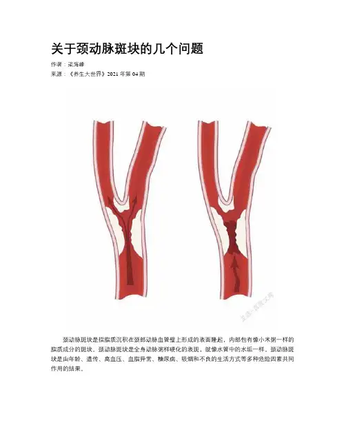 关于颈动脉斑块的几个问题