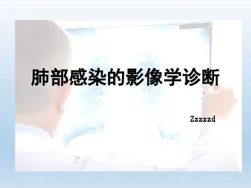 肺部感染的影像学诊断