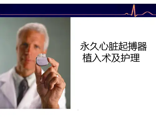 起搏器植入术ppt课件