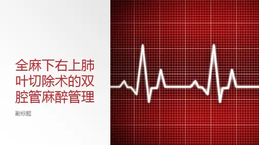 全麻下右上肺叶切除术的双腔管麻醉管理