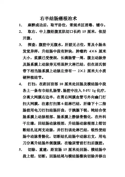 右半结肠癌根治术