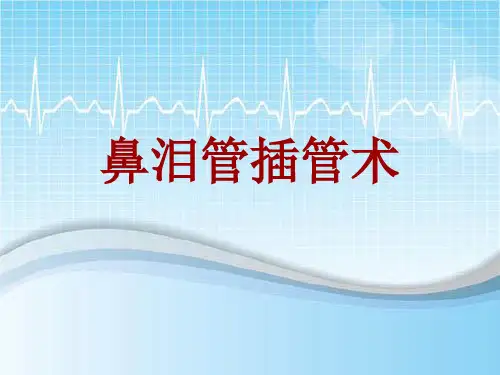 手术讲解模板：鼻泪管插管术