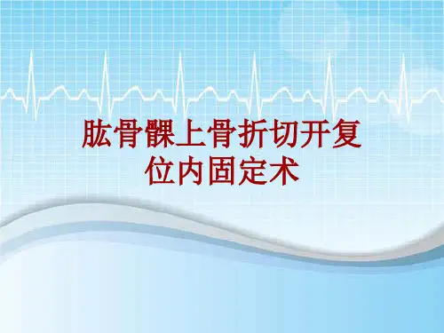 手术讲解模板：肱骨髁上骨折切开复位内固定术