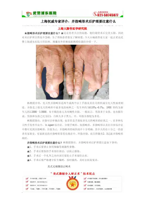 上海权威专家详介：并指畸形术后护理要注意什么【免费文献】
