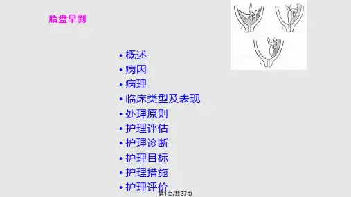 胎盘早剥护理PPT课件
