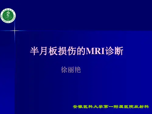 半月板损伤的诊断