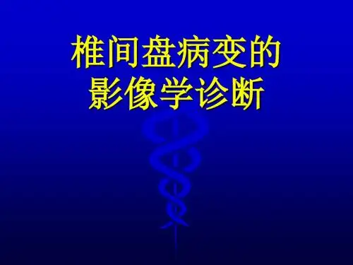 椎间盘病变影像诊断PPT课件