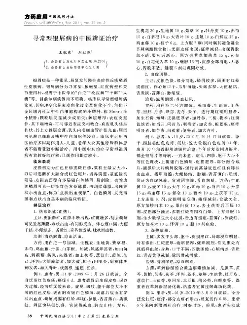 寻常型银屑病的中医辨证治疗