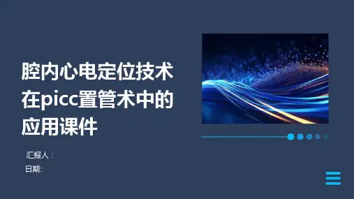 腔内心电定位技术在picc置管术中的应用课件