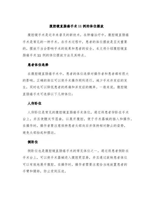 腹腔镜直肠癌手术11例的体位摆放