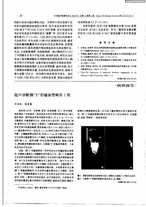 超声诊断倒“Y”形输尿管畸形1例