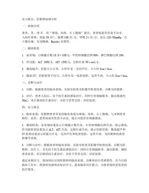 肝脓肿实习报告