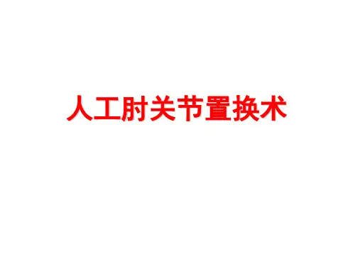 肘关节置换