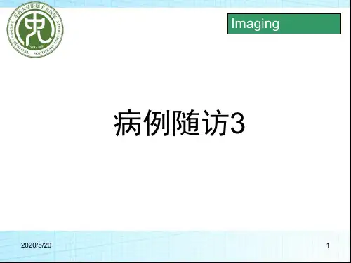 神经纤维瘤病ppt课件