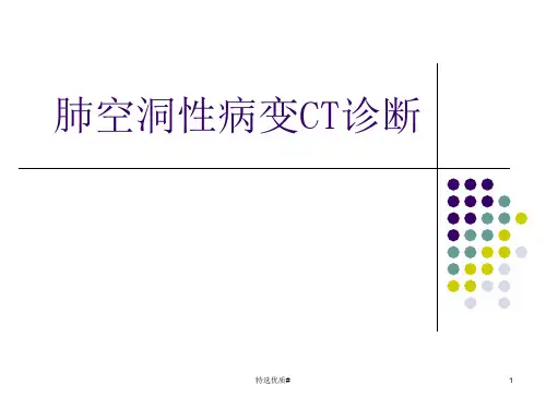 肺空洞性病变(资料参考)