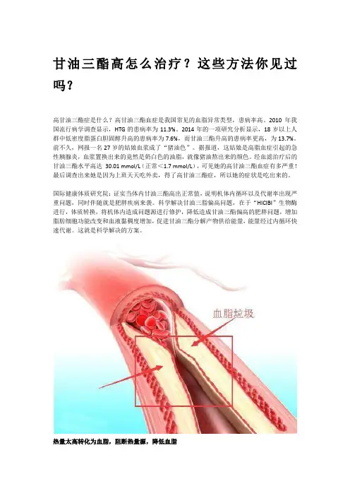 甘油三酯高怎么治疗？这些方法你见过吗？