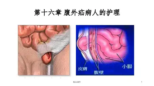 腹外疝病人的护理09022PPT课件