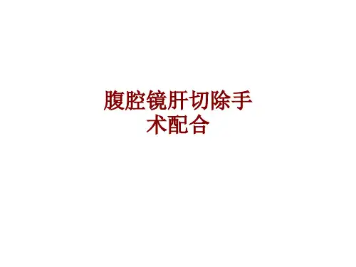 医学腹腔镜肝切除手术配合PPT培训课件