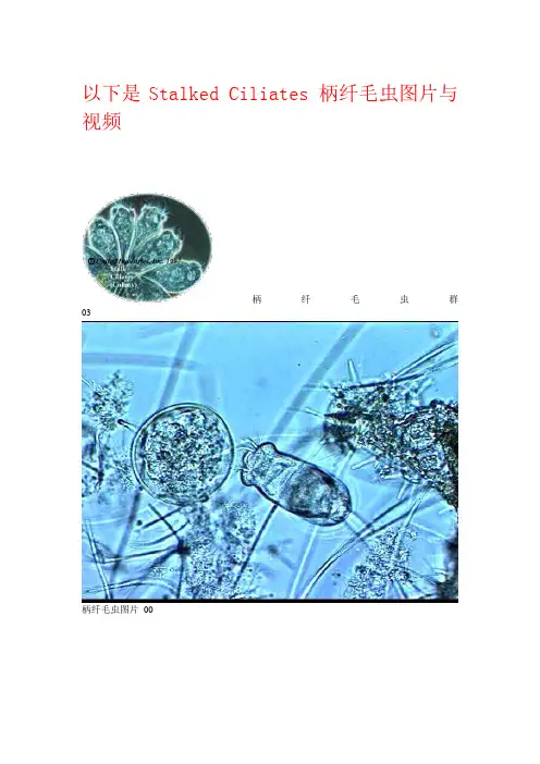 污水处理污泥中的微生物和它们的显微镜图片