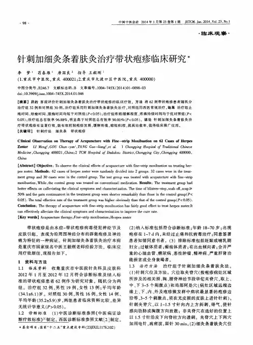 针刺加细灸条着肤灸治疗带状疱疹临床研究