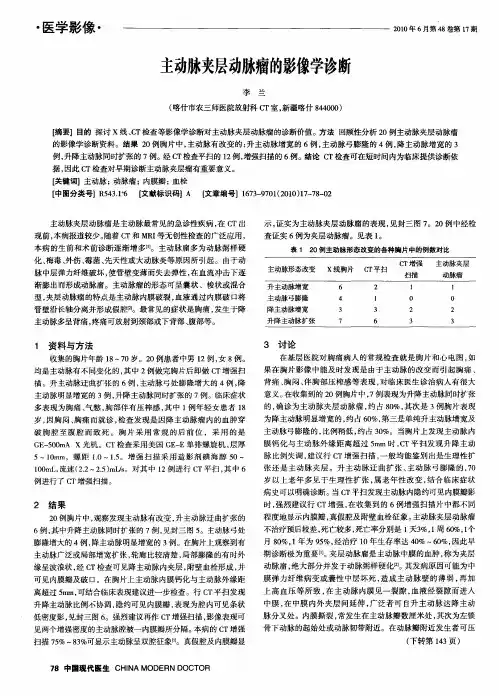 主动脉夹层动脉瘤的影像学诊断
