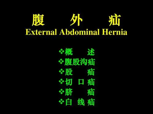 【医学超级全】腹外疝External_Abdominal_Hernia
